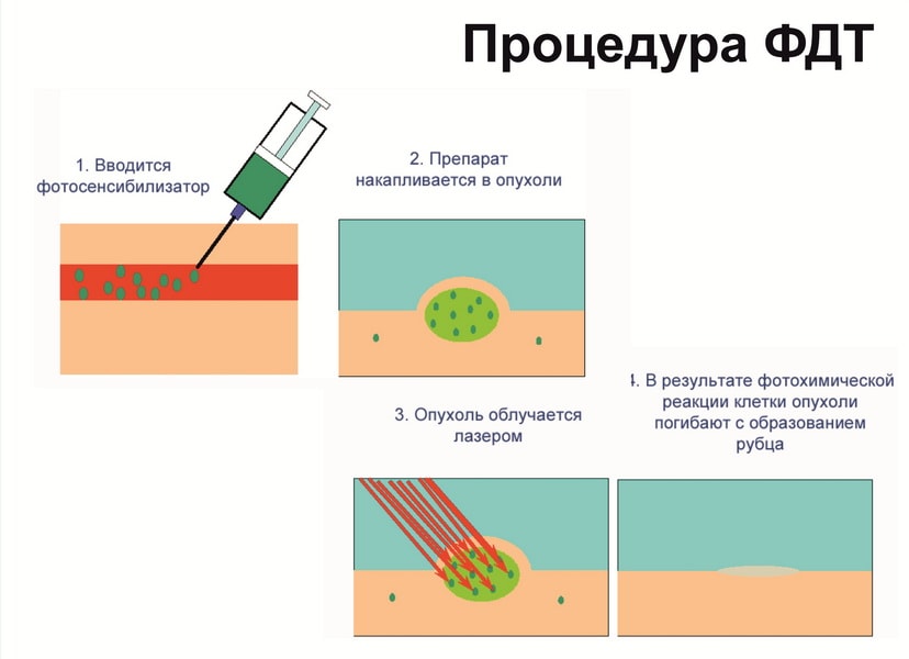 3 (1).jpg 3 (1).jpg